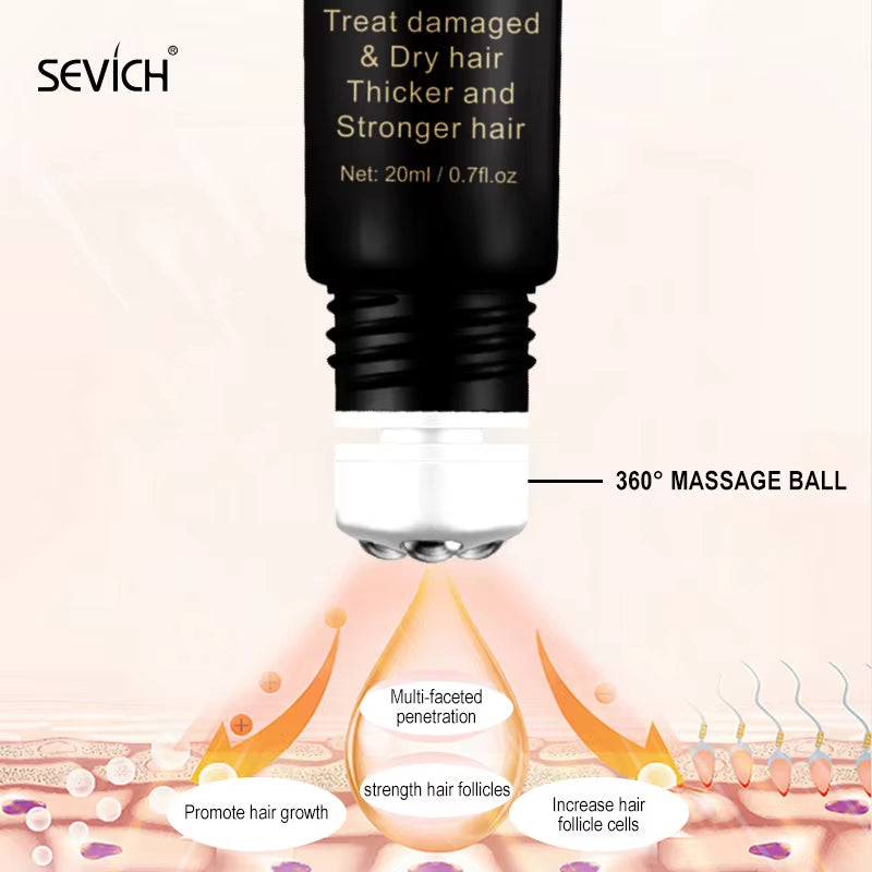 Herbal Fast Hair Growth Oil with Massage Roller 20Ml Hair Loss Treatment Ginger Extract Growing Serum Hair Loss Products