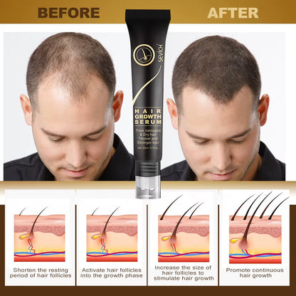 Herbal Fast Hair Growth Oil with Massage Roller 20Ml Hair Loss Treatment Ginger Extract Growing Serum Hair Loss Products